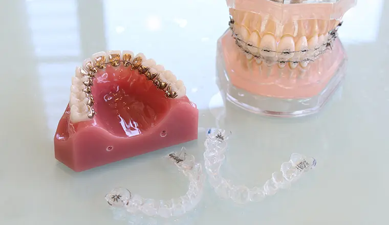 歯を動かす動的治療