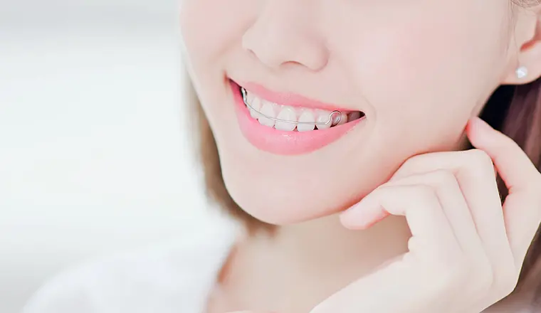 歯を固定させる静的治療、保定装置